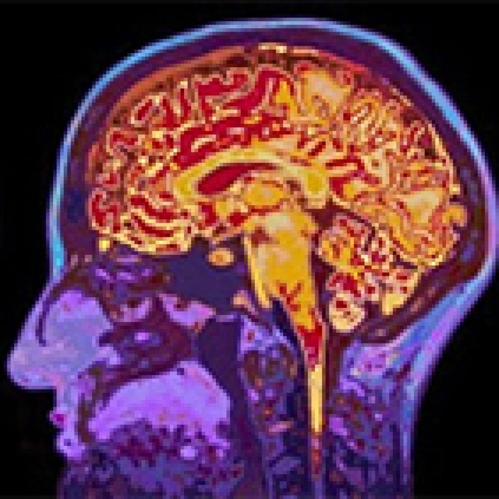 scan of brain health