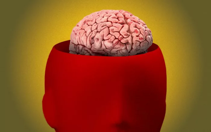 A red figure's head is open with the brain being exposed